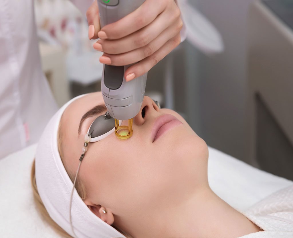 skin resurfacing, laser resurfacing near, resurfacing treatment near me