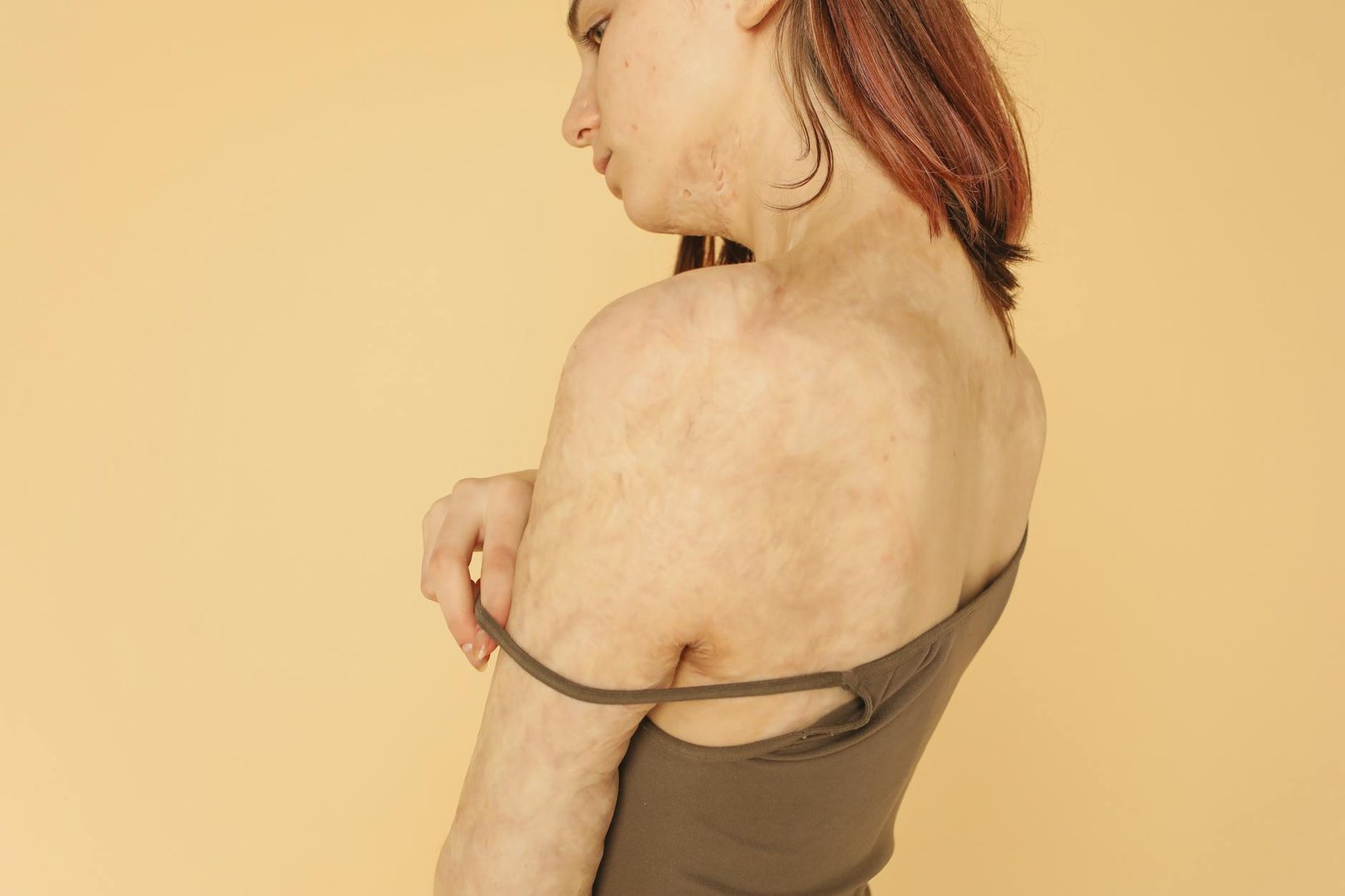 from insecure to empowered 5 inspiring plastic surgery stories